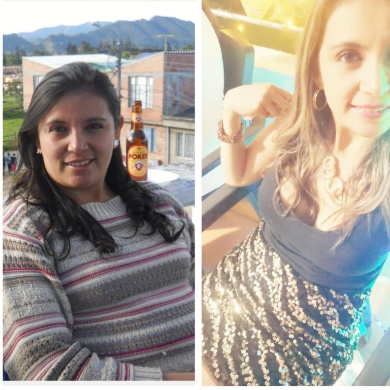 Foto de antes de paciente 2