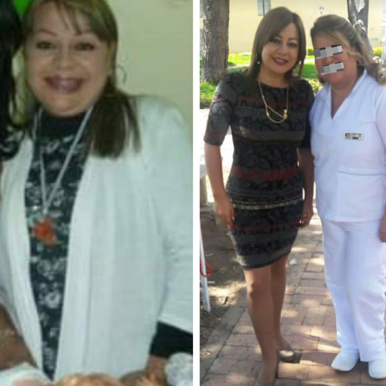 Foto de después de paciente 2