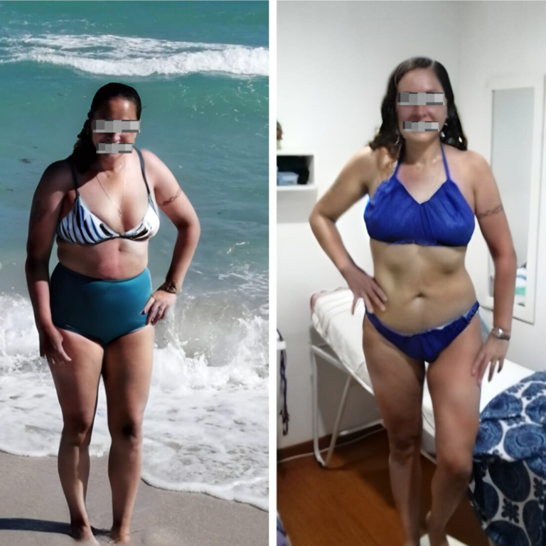 Foto de antes de paciente 1