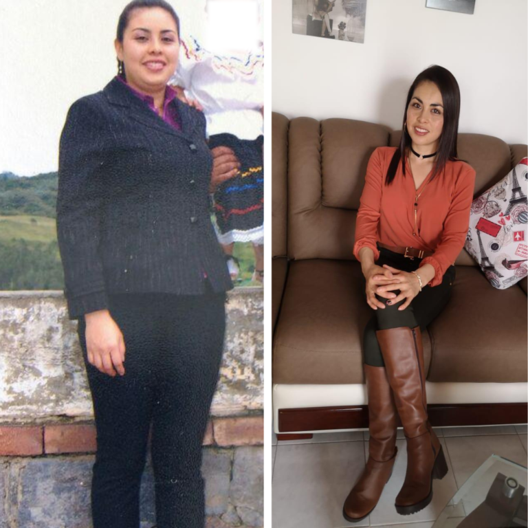 Foto de después de paciente 1